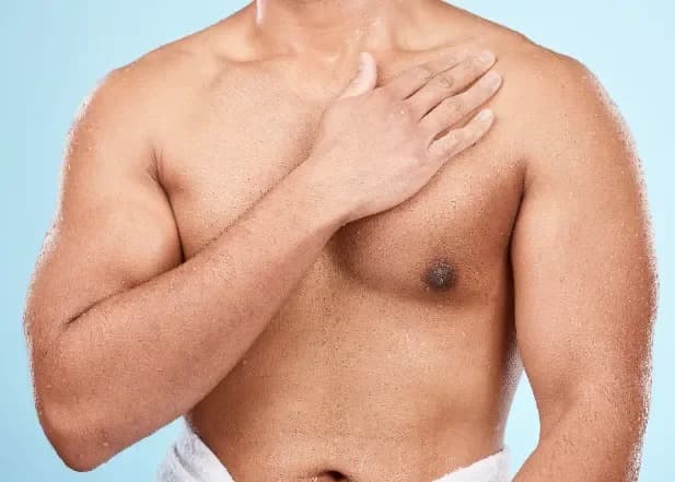 Minimal scar male breast reduction in Hyderabad Image of Minimal scar male breast reduction in Hyderabad