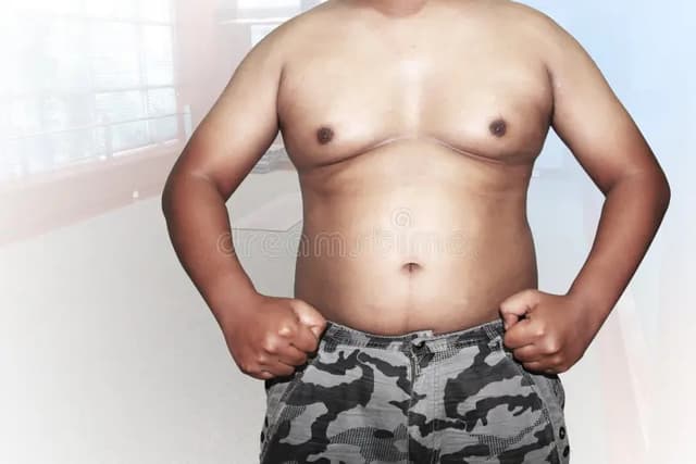 Best Gynaecomastia Surgeon in Hyderabad Image of Best Gynaecomastia Surgeon in Hyderabad