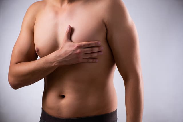 Gynaecomastia specialist in Hyderabad Image of Gynaecomastia specialist in Hyderabad