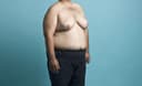 Best gynecomastia surgery clinic Hyderabad