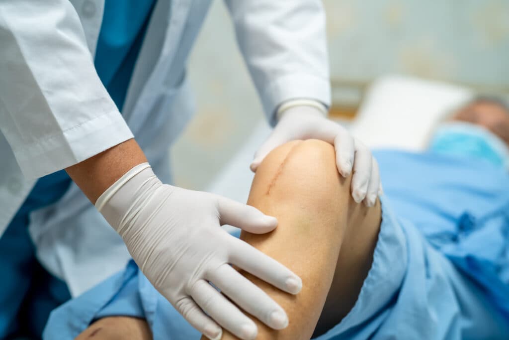 Image for home nursing for post knee surgery in Chennai