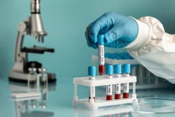 Image for Blood test at home Chennai