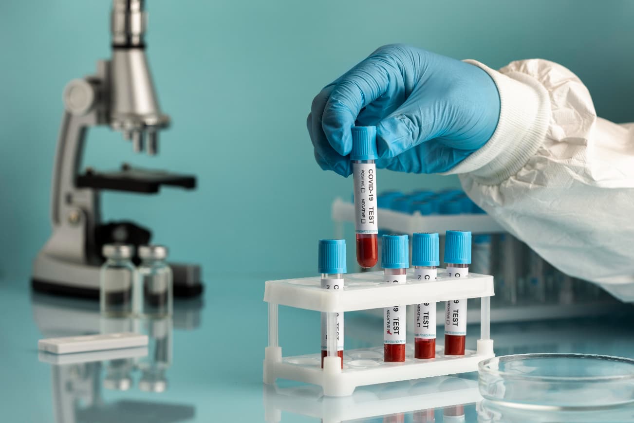 Blood test at home Chennai