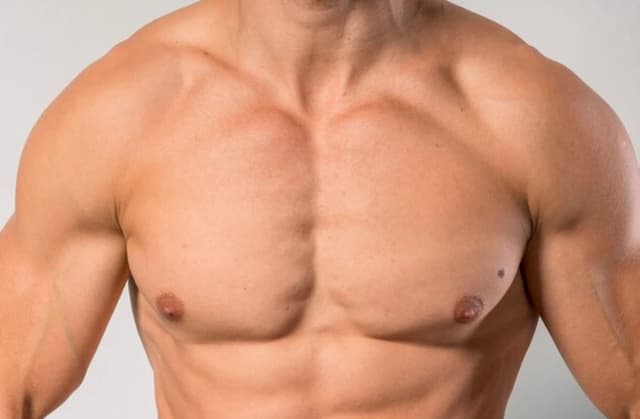 Male nipple reshaping surgery cost in Hyderabad Image of Male nipple reshaping surgery cost in Hyderabad