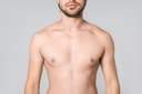 Male areola reduction in Hyderabad